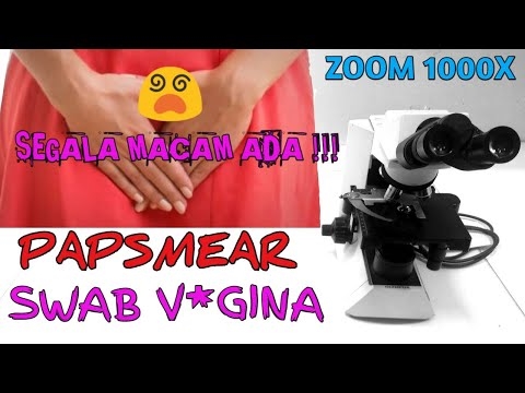 Bahaya pengulang (mengeluarkan ultrasound)